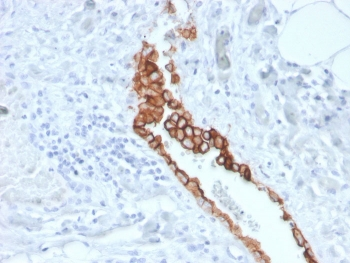 MSLN Antibody / Mesothelin