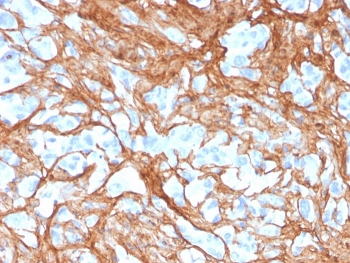 Periostin Antibody