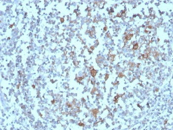 BAFF-R Antibody / BAFF Receptor