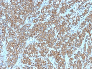IL1 alpha Antibody / IL1A
