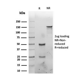 IL1 alpha Antibody / IL1A