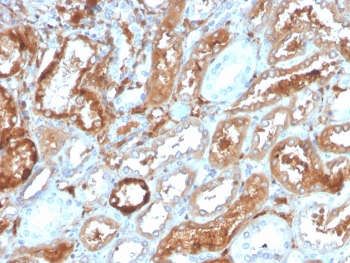 Retinol Binding Protein 4 Antibody / RBP4