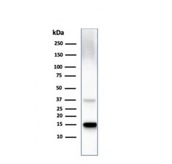Transthyretin Antibody