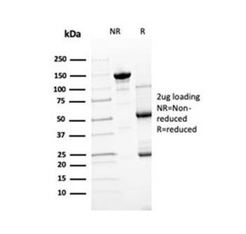 Transthyretin Antibody