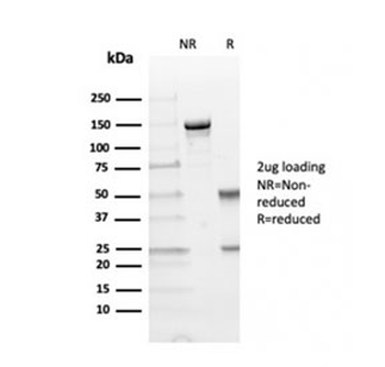TIM-3 Antibody / HAVCR2