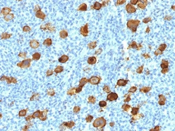 Recombinant CD30 Antibody