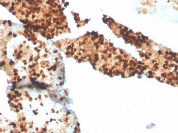 Recombinant S100P Antibody