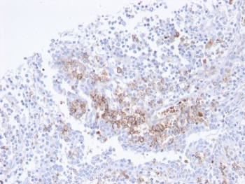Recombinant CD38 Antibody