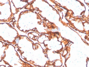 EGF Receptor / EGFR Antibody-L858R Mutant Specific