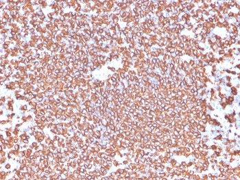 Recombinant CD20 Antibody