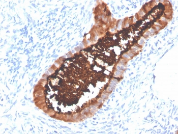 Recombinant MUC16 Antibody / CA125