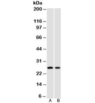 p27 Antibody / p27Kip1