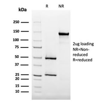 CD35 Antibody (Complement Receptor 1)