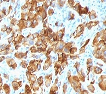 MART-1 Antibody