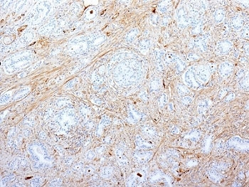 Fibronectin Antibody