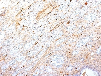 Fibronectin Antibody