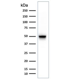 GFAP Antibody / Glial Fibrillary Acidic Protein