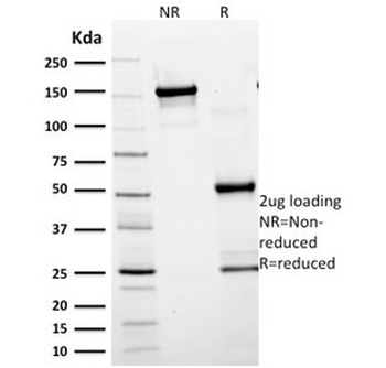 GFAP Antibody / Glial Fibrillary Acidic Protein