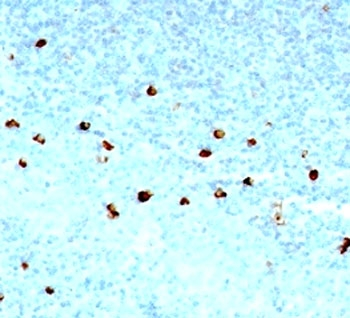 IgM Antibody