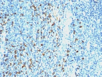 Lambda Antibody