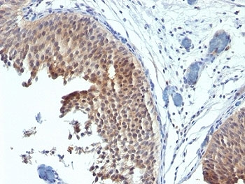 Keratin 6 Antibody / Cytokeratin 6