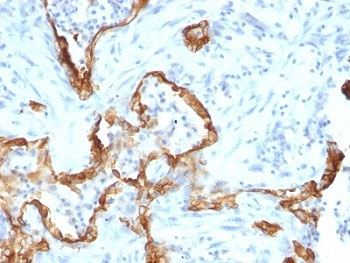 Cytokeratin 8 Antibody