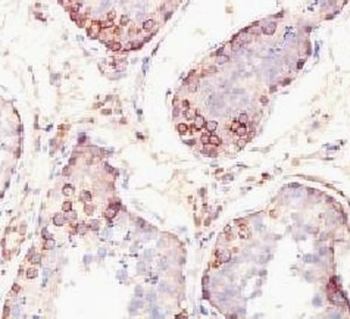 MAGE-1 Antibody