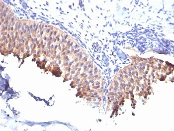Cytokeratin 10 Antibody