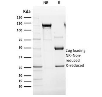 Cytokeratin 14 Antibody