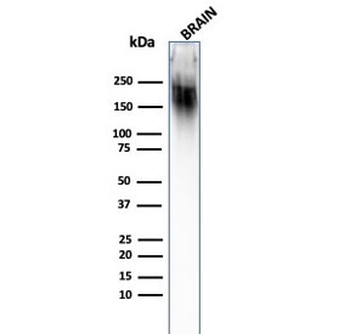 NF-H Antibody
