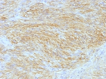 ANO1 Antibody / DOG1 / TMEM16A