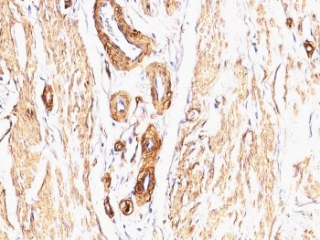 Smooth Muscle Actin Antibody