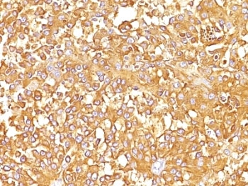 gp100 Antibody / PMEL17