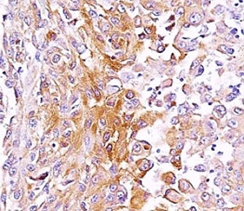 gp100 Antibody / PMEL17