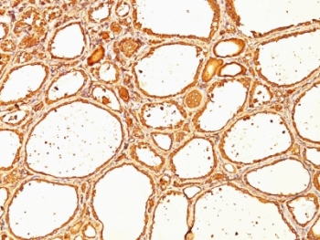 TG Antibody