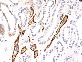 Complement 4d Antibody / C4d