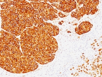 Tyrosinase Antibody