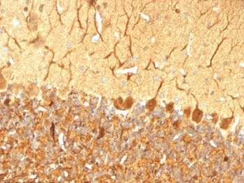 PGP9.5 Antibody