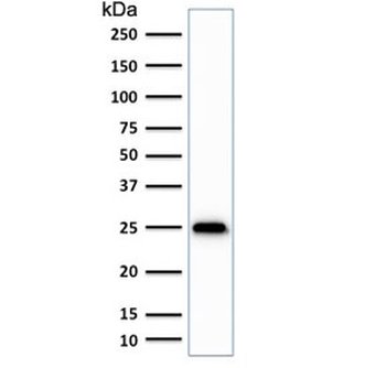 UchL1 Antibody