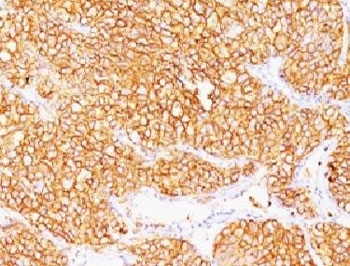 CA9 Antibody