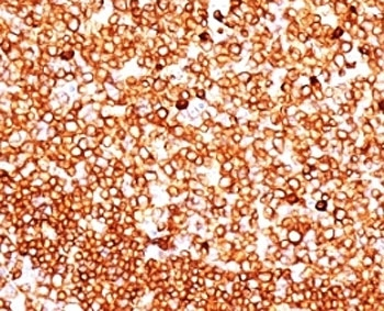 CD79 Antibody