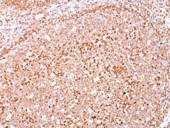 CD79a Antibody