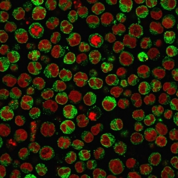 CD79a Antibody