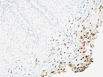 L1 Antibody