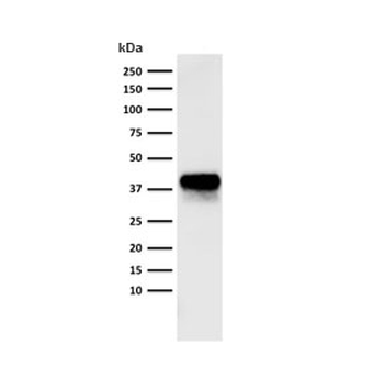 EpCAM Antibody Cocktail