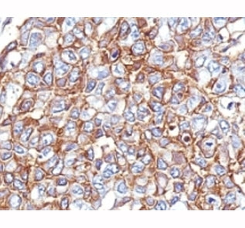 EpCAM Antibody Cocktail