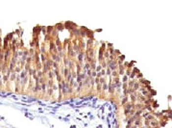 Cytokeratin 10 Antibody