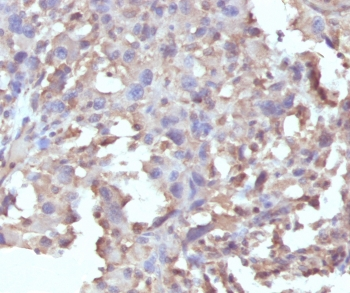 TNF alpha Antibody