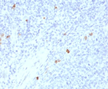 IgG4 Antibody