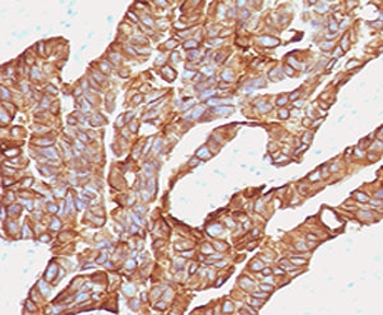 EpCAM Antibody (Extracellular domain)